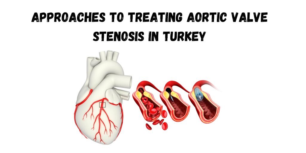 Aortic Valve Stenosis