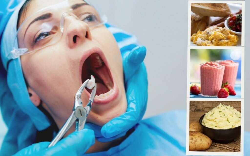 what can i eat after tooth extraction